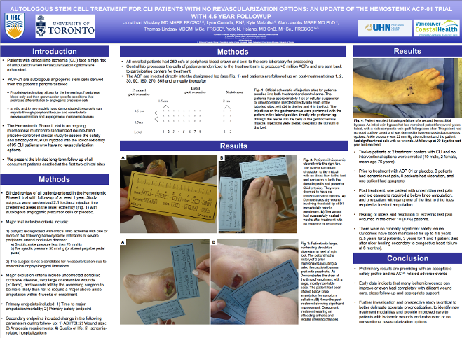 VesCell_Stem Cell Treatment for CLI_2023 Poster VesCell_Stem Cell Treatment for CLI_2023 Poster